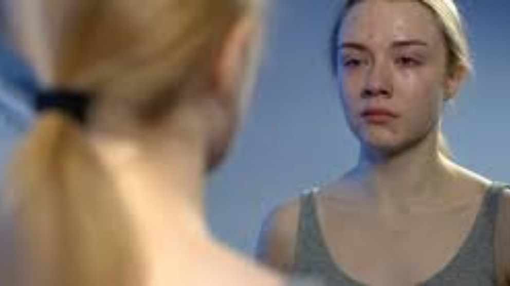 Body Dysmorphia is cured by Therapist Doctor Brodsky 